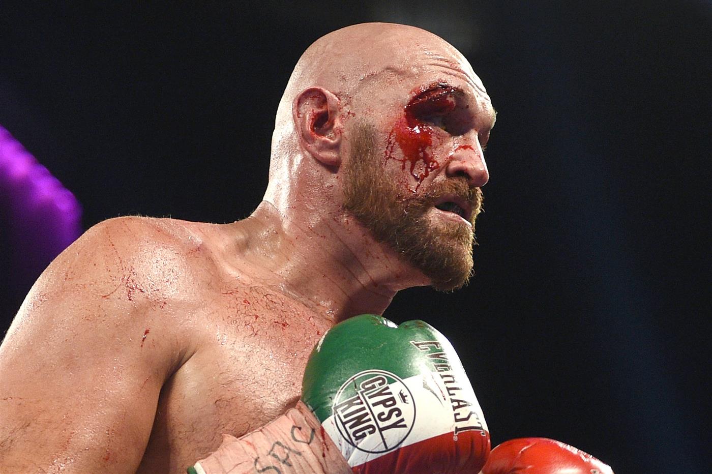 Tyson Fury vs Deontay Wilder Odds | Tyson Fury Odds-On ...